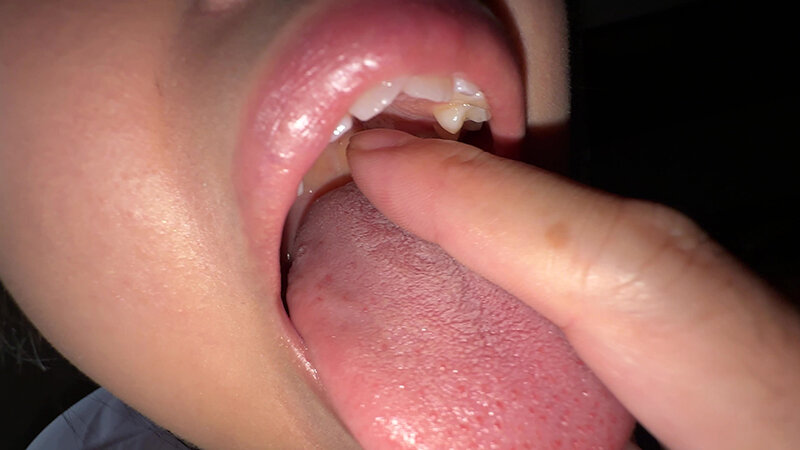 【個人撮影】谷田かりな 開口器で口内観察デカ舌を要チェック サンプル画像 12