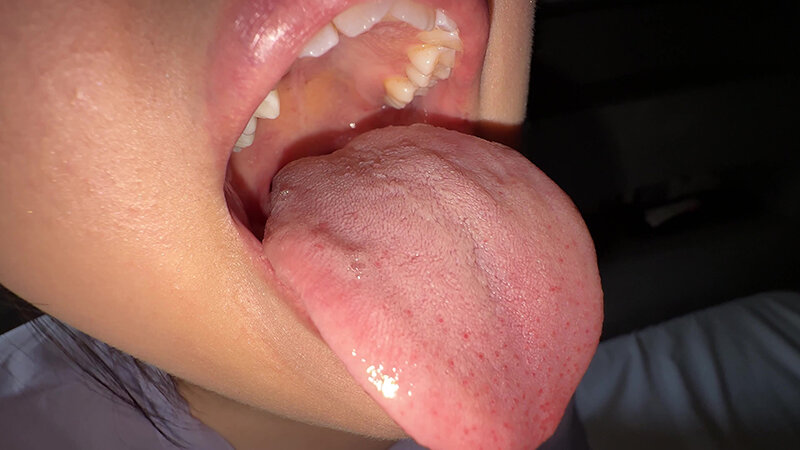 【個人撮影】谷田かりな 開口器で口内観察デカ舌を要チェック サンプル画像 8