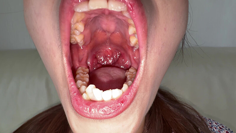 【個人撮影】水月みお 初喉チンコ触り＆舌や八重歯を観察 サンプル画像 3