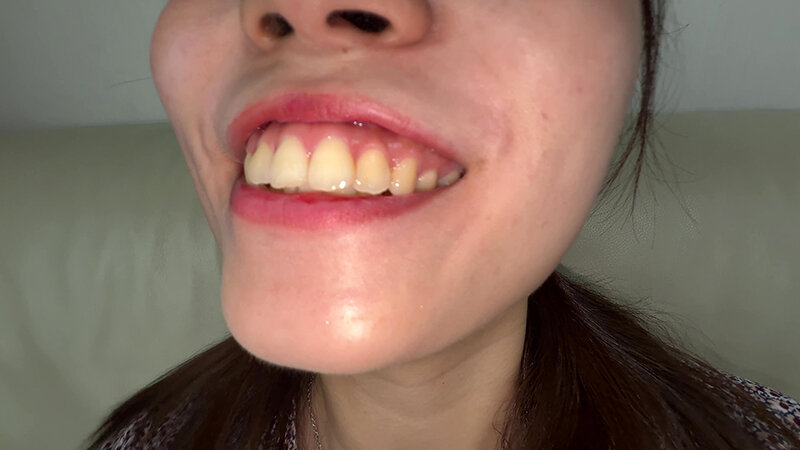 【個人撮影】水月みお 初喉チンコ触り＆舌や八重歯を観察 サンプル画像 5