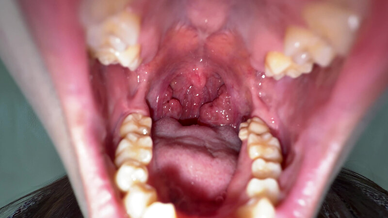 【個人撮影】水月みお 初喉チンコ触り＆舌や八重歯を観察 サンプル画像 7