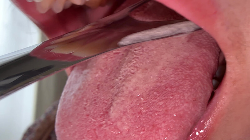 【個人撮影】水月みおの舌ブラシで「汚舌苔」採取 サンプル画像 11