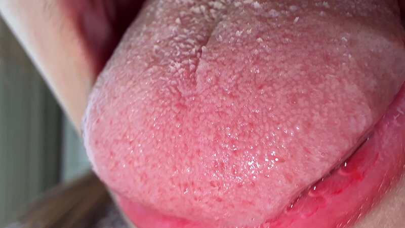 【個人撮影】水月みおの舌ブラシで「汚舌苔」採取 サンプル画像 12