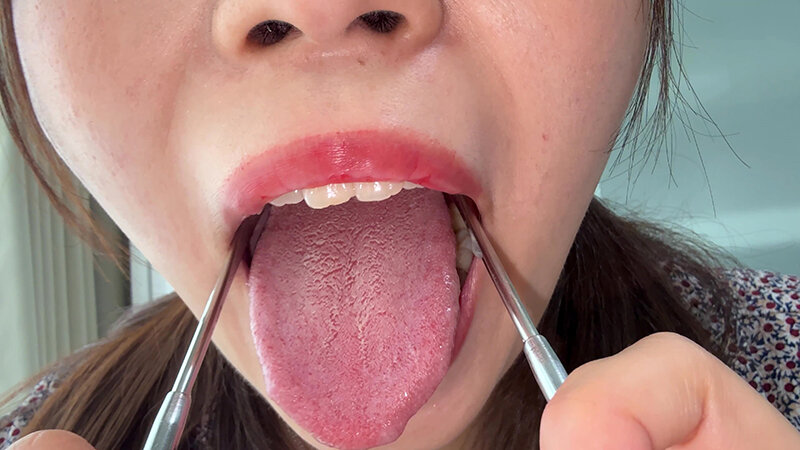 【個人撮影】水月みおの舌ブラシで「汚舌苔」採取 サンプル画像 16