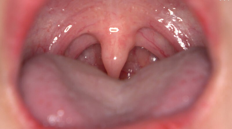 AD-2007 「【歯・口腔フェチ】新人女優相楽さゆなちゃんの口内観察＆巨大女フェチ」わかしラボWAKA-078 相楽さゆな 9